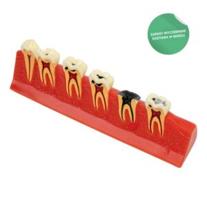 Model próchnicy zębów, #1957