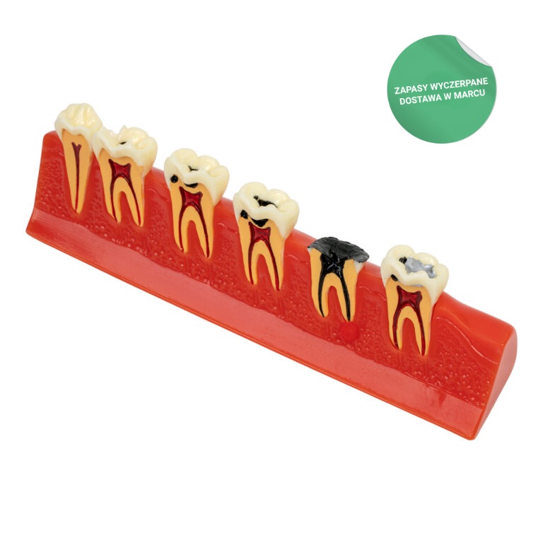 Model próchnicy zębów, #1957