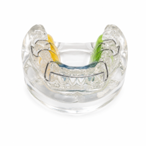 Clear dental retainer with colored sections (yellow, blue, green) on a white background; an orthodontic appliance for teeth alignment.