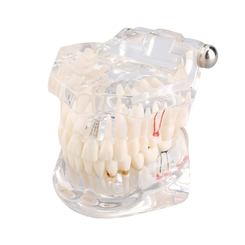 Przezroczysty model szczęki człowieka