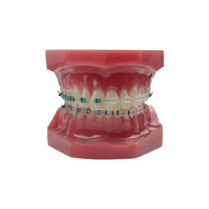 Dentystyczny model szczęki człowieka z aparatem ortodontycznym
