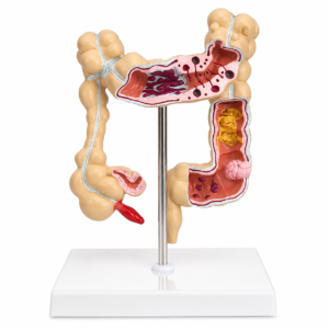 An anatomical model of the human large intestine on a stand, showing cross-sections and internal structures for educational use.