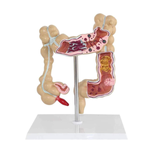 Model jelita grubego, #4047